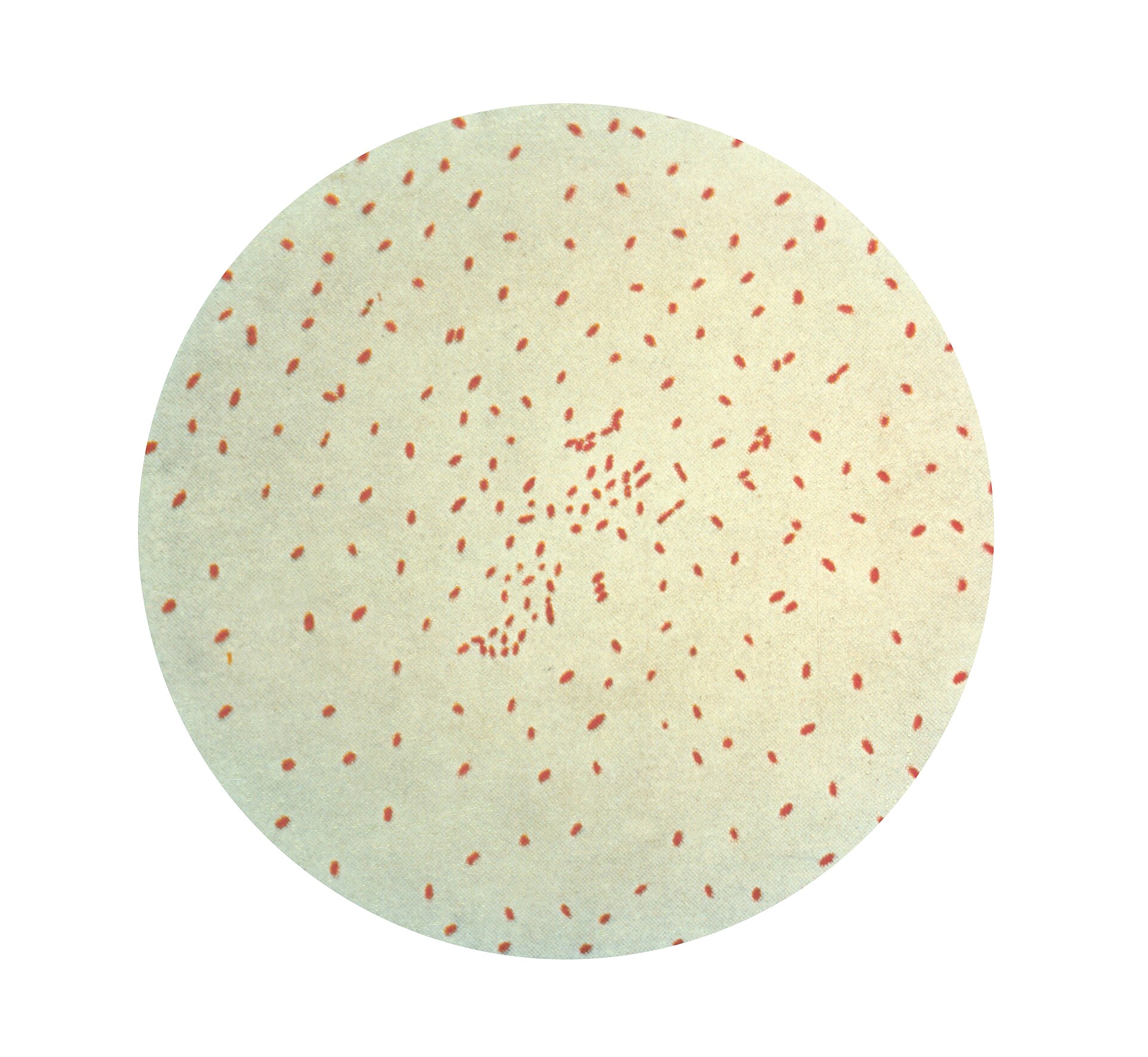 Imagem de referência relacionada a Bordetella pertussis, item descrito como agente etiológico da Coqueluche