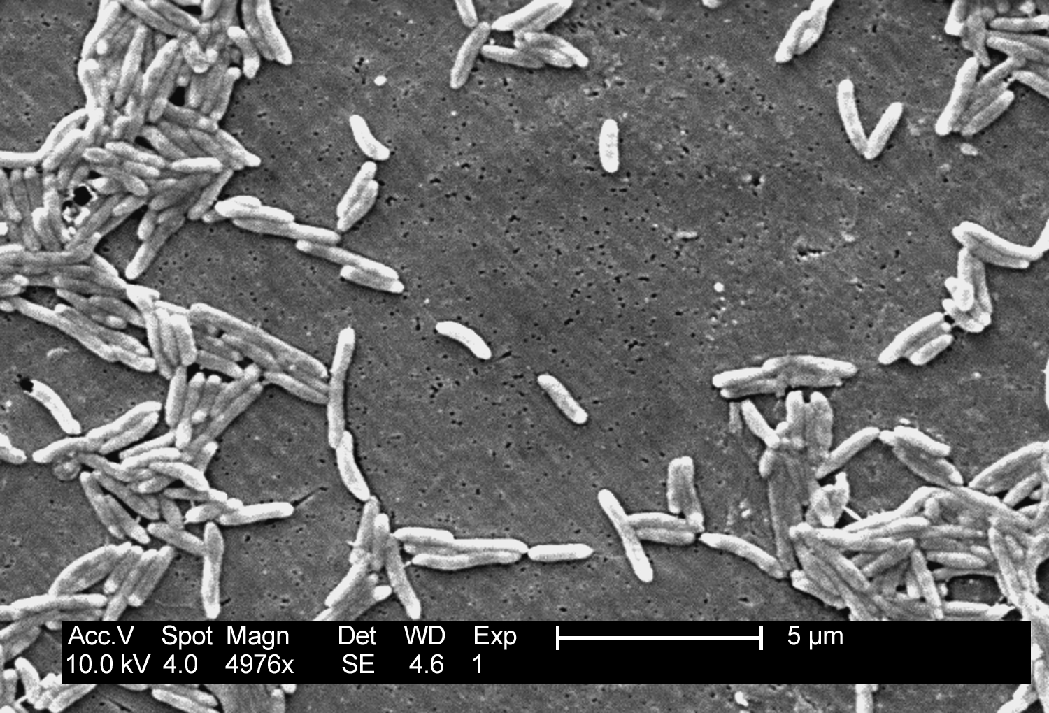 Imagem de referência relacionada a Campylobacter fetus, item descrito como registro de referência sobre Campylobacter fetus, organizado a partir de dados estruturados abertos
