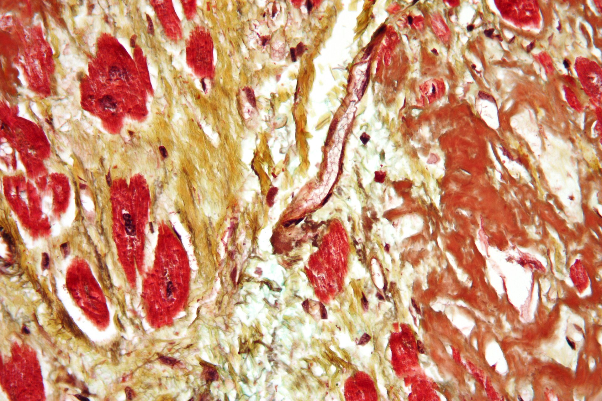 Imagem de referência de doença cardiovascular, descrito nos dados abertos como grupo de doenças que afetam o coração ou os vasos sanguíneos