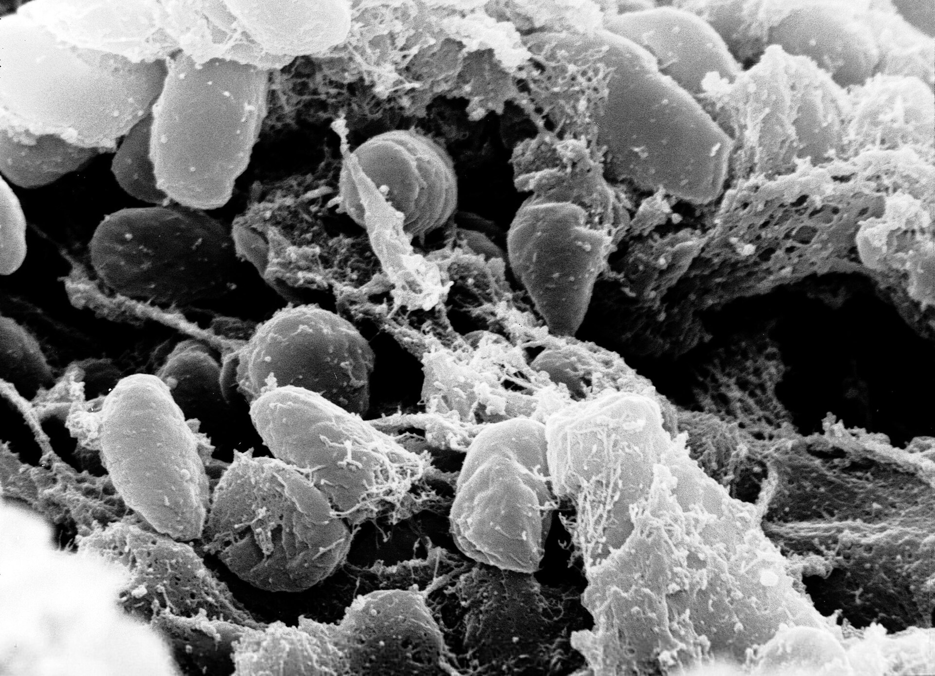 Imagem de referência de Yersinia pestis, descrito nos dados abertos como bactéria gram-negativa