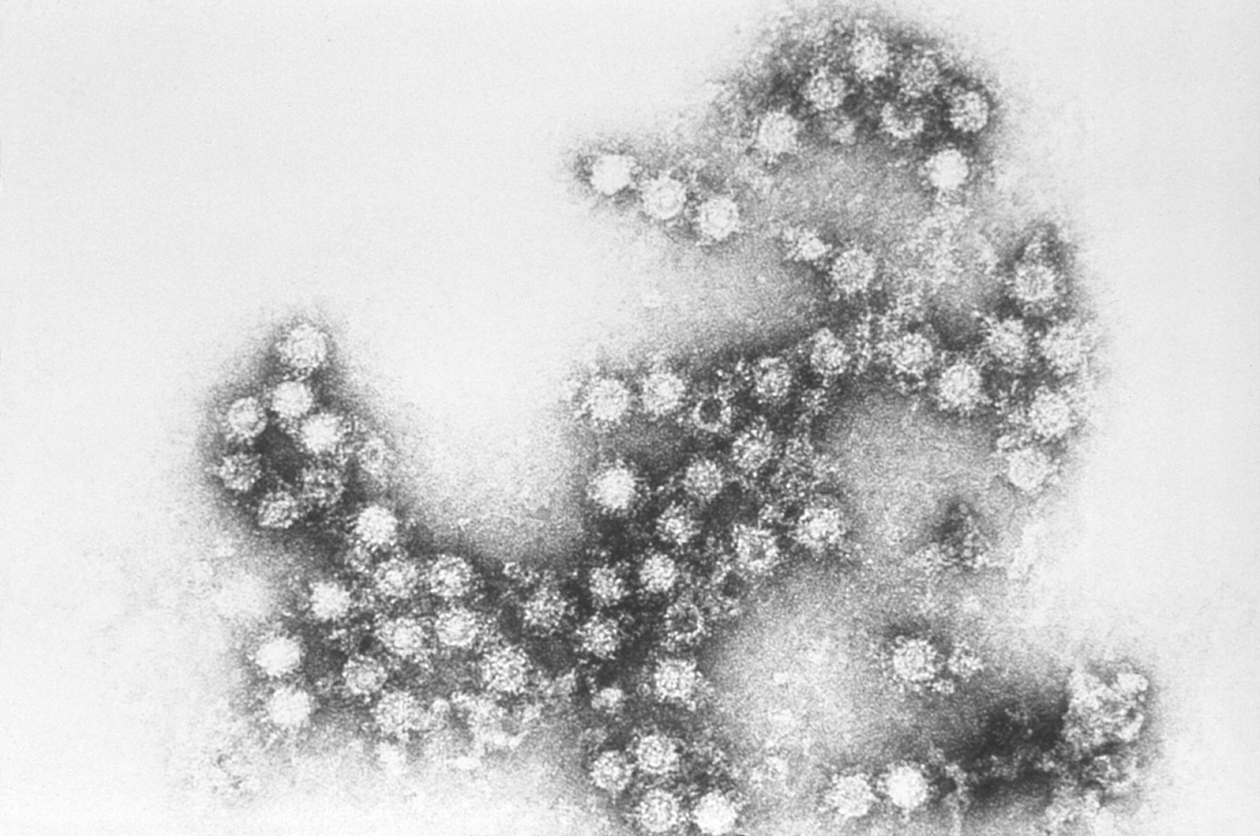 Imagem de referência de Enterovirus, descrito nos dados abertos como gênero de vírus da família Picornaviridea