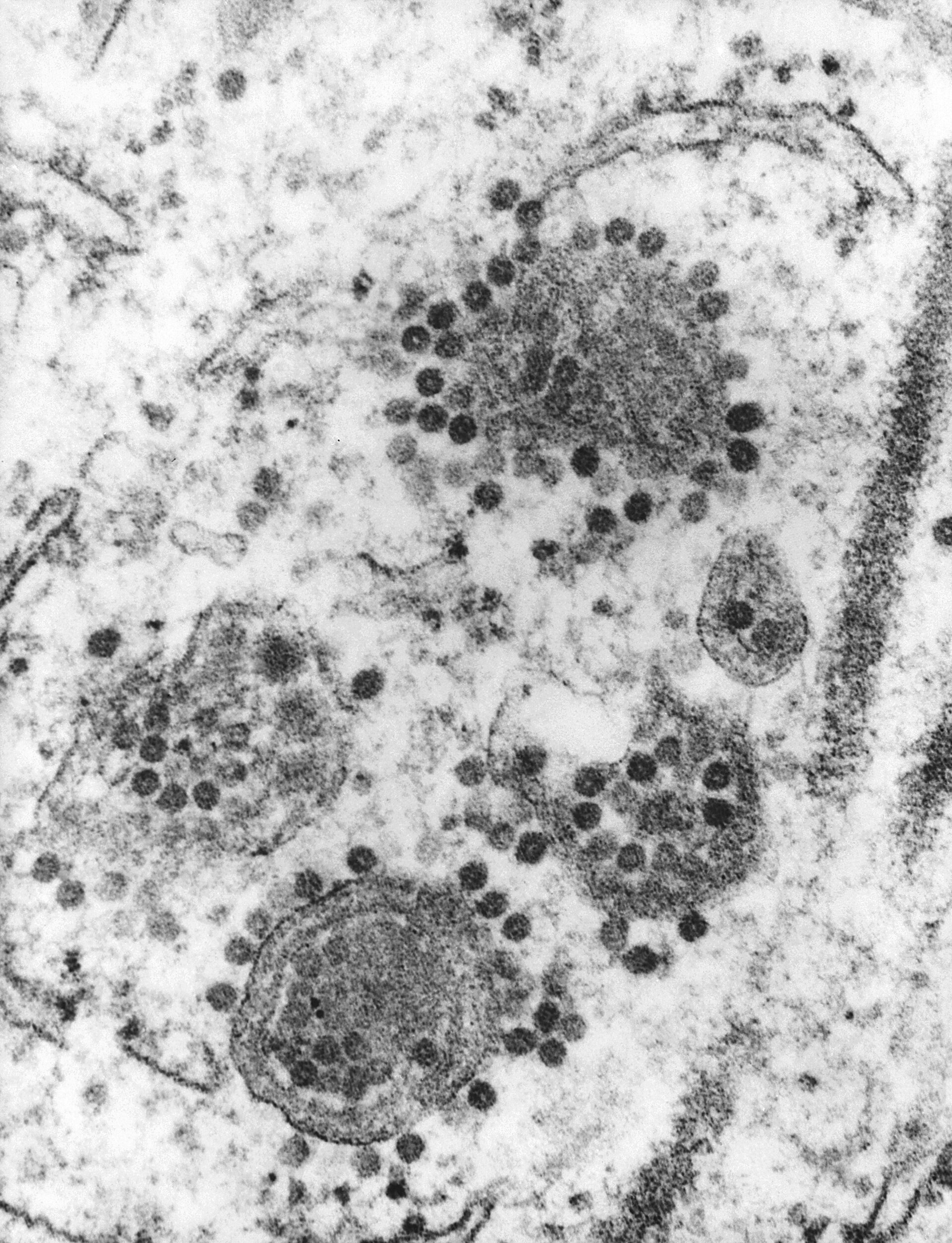 Imagem de referência de Alphavirus, descrito nos dados abertos como gênero de vírus