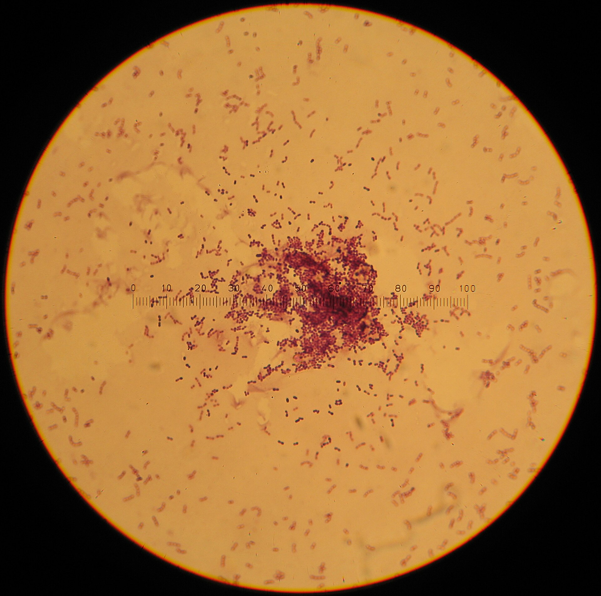 Imagem de referência relacionada a Lactococcus, item descrito como registro de referência sobre Lactococcus, organizado a partir de dados estruturados abertos