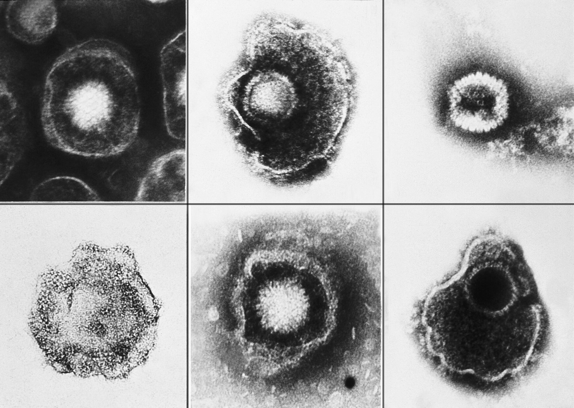 Imagem de referência de Herpesviridae, descrito nos dados abertos como família de vírus de DNA