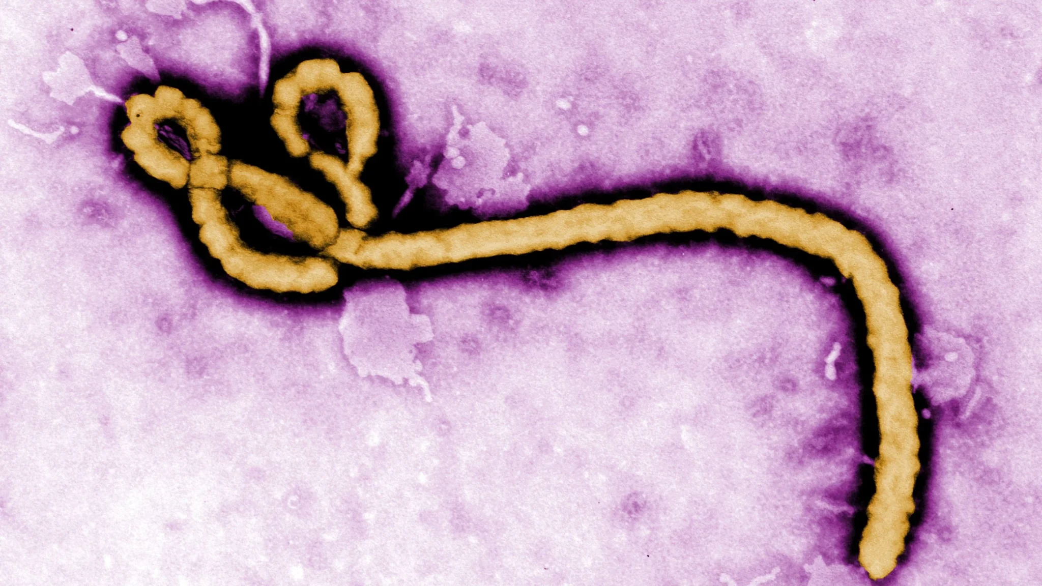 Imagem da matéria: Ebola: FG coloca 46 pessoas expostas em lista de proibição de voo por 21 dias