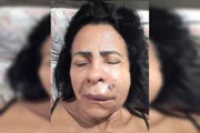 Rita Castro de Araújo