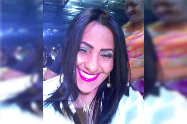 PMMA: dentista que deformou mulher é condenado, mas dá calote de R$ 97 mil