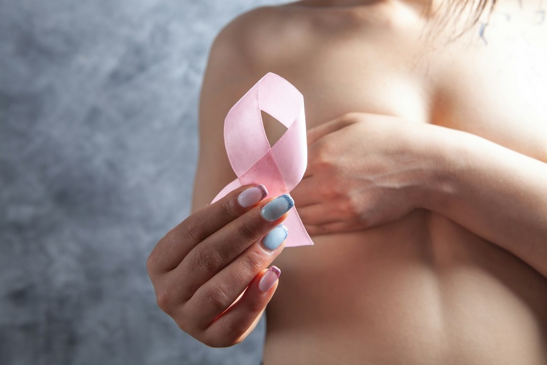 Breast cancer is one of the most common cancers diagnosed during pregnancy. (Unsplash)